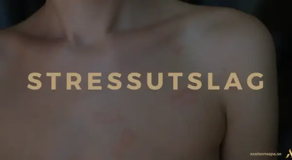 När stressen sätter sig på huden syns det som ett tydligt stressutslag.